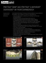 Fallgalerie Prettau® Skin® - 2