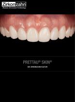 Fallgalerie Prettau® Skin®-1