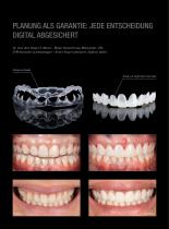 Fallgalerie Prettau® Skin®-3