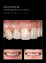 Fallgalerie  Prettau® Skin®-3