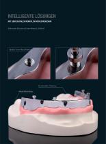 Fallgallerie Double Screw Bar - 3