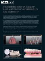 Fallgallerie Raw-Abutment® - 2