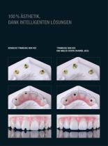 Titanbasen K80 Angeled Screw Channel - 3