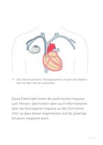 Congestive Heart Failure Therapy System - 17