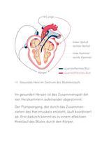 Congestive Heart Failure Therapy System - 6