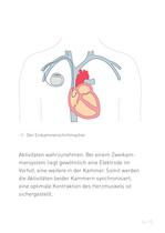 Pacemaker - 15