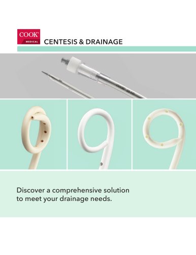 Centesis and Drainage Talking Guide