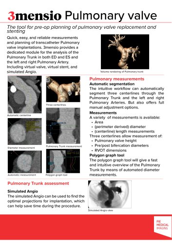 3mensio Pulmonary valve