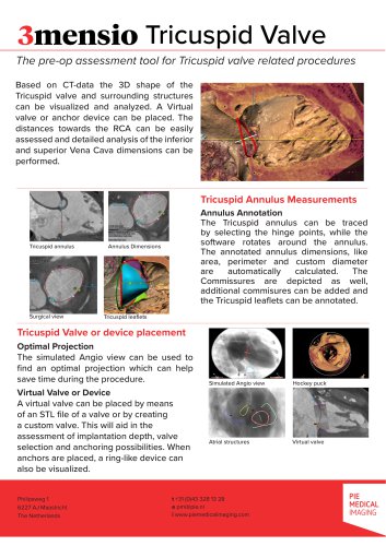 3mensio SH Tricuspid Valve