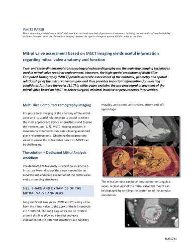 WHITE PAPER Mitral valve assessment based on MSCT imaging yields useful information regarding mitral valve anatomy and function