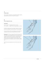 Variable Angle LCP Forefoot/Midfoot System 2.4/2.7 - 9