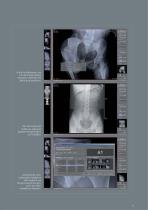 dicomPacs DX-R Akquisitions- und Befund software - 13