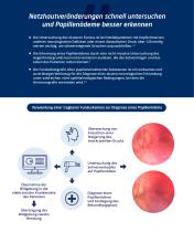 Verbesserte Fundusuntersuchung  in der Neurologie mit Optomed Auror IQ-2