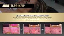 Perfectlaser Z110Pro Alexandrit-Laser-Langpuls-Haarentfernungsgerät - 11